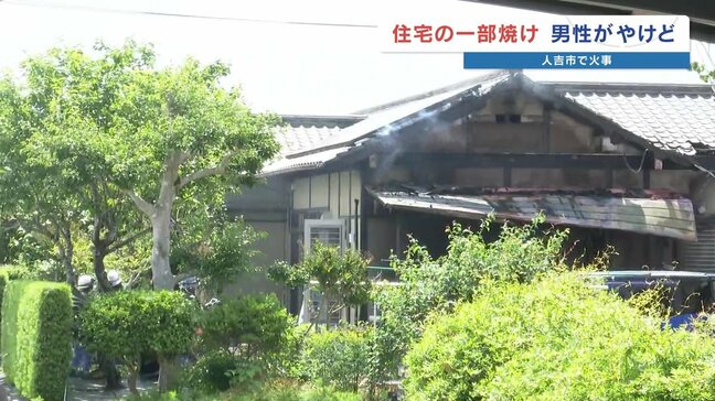 60代の男性が手と足にやけど 木造平屋の一部が焼ける|TBS NEWS DIG