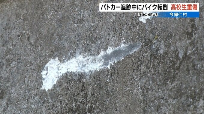 パトカー追跡中にバイク横転　高校生が肩骨折など重傷　|　沖縄のニュース｜RBC 琉球放送