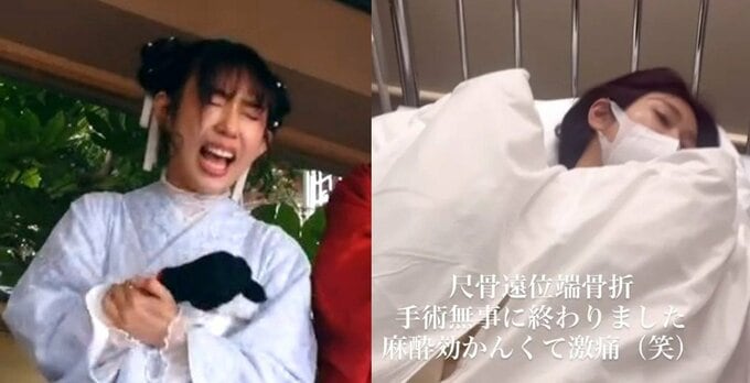 【 堀江聖夏 】　骨折の右腕　「手術無事に終わりました　麻酔効かんくて激痛(笑)」　前日に「板割り」で右腕を骨折|TBS NEWS DIG