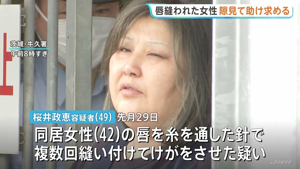 唇を縫われた女性、容疑者が外出した隙に近くの商店に助け求める　49歳女が針と糸で…