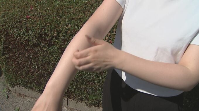 「О型の人」「黒い服を着ている人」は蚊に刺されやすい？　ウソ？ホント？専門家に聞いた　|　BSSニュース | BSS山陰放送