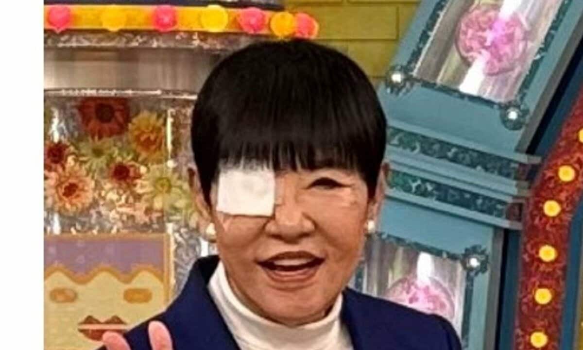 和田アキ子さん 右目の手術を報告 「眼瞼内反症」のため 「アッコにおまかせ!」に眼帯姿で出演 | TBS NEWS DIG