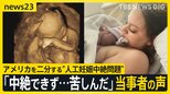 「中絶できず…苦しんだ」アメリカを二分する人工妊娠中絶問題　大統領選の有権者50％以上が関心【news23】|TBS NEWS DIG