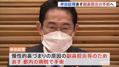 岸田総理、鼻づまりであす東京都内で内視鏡による手術受けると表明 臨時代理は松野長官| TBS CROSS DIG with Bloomberg
