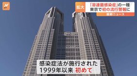 東京都が「A群溶血性レンサ球菌咽頭炎」流行警報を発表　都内では初|TBS NEWS DIG