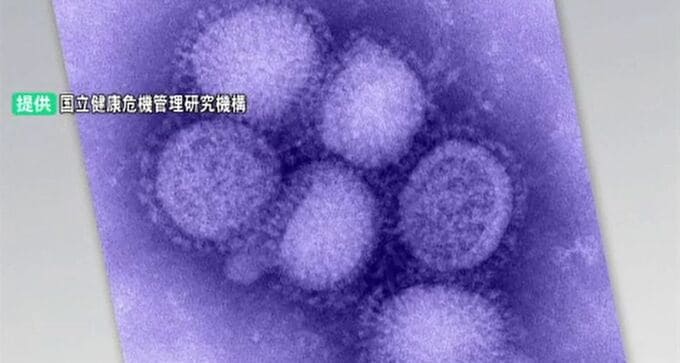 金沢市で警報基準の2倍超過 石川県内インフルエンザ報告数は前週比600人増の2423人に　|　石川県のニュース｜MRO北陸放送