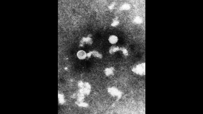 手足口病「警報レベル」に　子ども中心に夏流行、口の中や手足に発疹　福島　|　福島のニュース│TUF