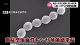 「手足口病」に"人食いバクテリア"「劇症型溶連菌」など 感染症への対策徹底を 専門家に聞く | MRTニュース | MRT宮崎放送
