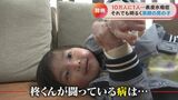 お風呂で激痛、止まらない涙…全身に水疱ができる指定難病「表皮水疱症」と闘いながら生きる少年の日常に密着 | 名古屋・愛知・岐阜・三重のニュース【CBC news】 | CBC web
