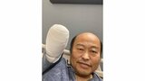 佐野慈紀さん 「ぬいぐるみみたい。。。」「至って元気」 右腕切断手術後、初めて写真を公開|TBS NEWS DIG