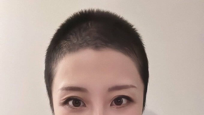 【がんサバイバー】西丸優子さん「キウイからのマリモヘア」抗がん剤による脱毛状態から発毛に「今のところカット無し」|TBS NEWS DIG