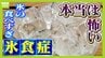 氷ガリガリ『氷食症』の人は貧血かも！？裏に病気が隠れていることも　６０代女性「４０代から氷がおいしくて...病気や貧血の治療後は食べたくなくなった」　|　MBSニュース | 関西の最新ニュースを分かりやすく。