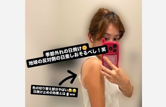 【 中川安奈 】 「季節外れの日焼け　地球の反対側の日差しおそるべし！笑」「本当に日焼けしやすい体質で笑笑」|TBS NEWS DIG