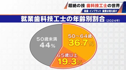 入れ歯難民”に？減り続ける歯科技工士 現役の約半数が50歳以上