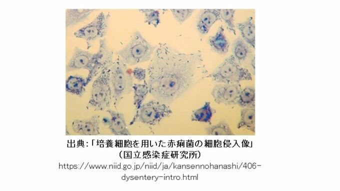 40代女性1人が「細菌性赤痢」と診断　岡山県内で今年度初　|　岡山・香川のニュース | 天気 | RSK山陽放送