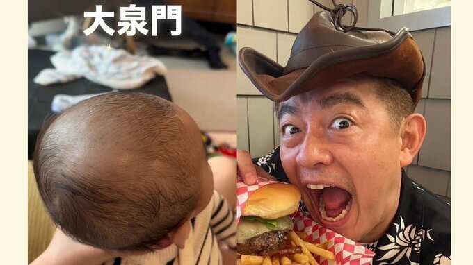 【井戸田潤】息子の赤ちゃん「頭ぴょこぴょこ」に「なにこれ」　フォロワーから「触らないで」乳幼児の大事な部位「大泉門」|TBS NEWS DIG