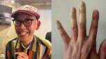 【 坂本ちゃん 】　指先の「激しい変色」で困惑　「きゃー！やだー！」「指先冷えてたいへーん！」　ファンからは「今すぐ病院行って」と心配の声|TBS NEWS DIG