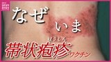 なぜいま？「帯状疱疹」ワクチンが定期接種化　予防したいのはより辛い「後遺症」　“水疱瘡が減って帯状疱疹は増加” その背景は|TBS NEWS DIG