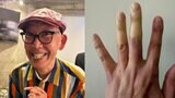 【 坂本ちゃん 】 指先の「激しい変色」で困惑 「きゃー!やだー!」「指先冷えてたいへーん!」 ファンからは「今すぐ病院行って」と心配の声|TBS NEWS DIG