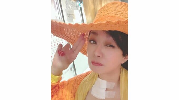 北山みつきさん（55）「帯状疱疹になっちゃった」オスマン・サンコンさんの第３夫人「全身に広がらなければ良いな」|TBS NEWS DIG