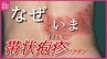 なぜいま？「帯状疱疹」ワクチンが定期接種化　予防したいのはより辛い「後遺症」　“水疱瘡が減って帯状疱疹は増加” その背景は　|　RCC NEWS | 広島ニュース | RCC中国放送