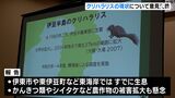 愛らしい顔なのに…生態系に悪影響の恐れ「クリハラリス」の繁殖状況や対応で意見交換＝静岡・伊豆市|TBS NEWS DIG