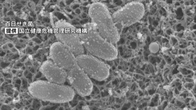 福岡で「百日咳」急増　過去最多ペース　生後２か月以内の赤ちゃんに注意呼びかけ|TBS NEWS DIG