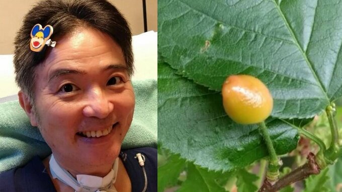 【 ニャンちゅう 】 声優・津久井教生さん　ベランダの鉢植えにサクランボが実ったことを報告　「妻と楽しみにしているのですが　鳥も楽しみにしているようです」「生きる力ってすごい」　【ＡＬＳ闘病】|TBS NEWS DIG