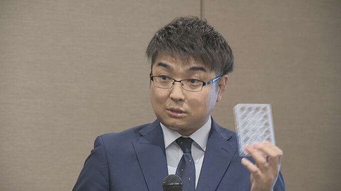 脳疾患治療に革命を！山口大学発スタートアップ企業に市が補助金　本格始動へ|TBS NEWS DIG