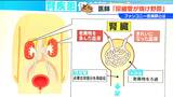 サプリ健康被害「ファンコニー症候群」とは? 小林製薬は“床にこぼれた材料”で紅麹原料を製造していたことが明らかに|TBS NEWS DIG