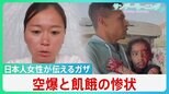 “空爆と飢餓で極限状態”ガザで病院支援　現地入り日本人女性が伝える惨状「鎮痛剤なく子供たちの叫ぶ声が･･･」【サンデーモーニング】|TBS NEWS DIG