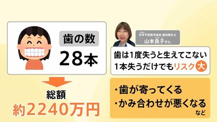 歯1本の資産価値は約80万円!? 歯周病になりやすい人の特徴、予防法は