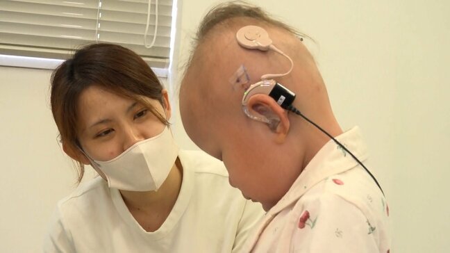 「少しでも音を聞かせてあげたい」難病・魚鱗癬の女の子”ちーちゃん”が人工内耳の手術　訪れた変化|TBS NEWS DIG