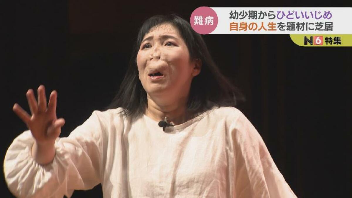 真心 実 やりたいことをやれる世の中に」顔に難病抱える河除静香さん 大学生との2人芝居に挑戦 富山・南砺市 | 富山のニュース|天気・防災|チューリップテレビ (1ページ)