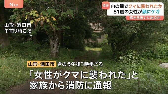 81歳の女性がクマに顔をひっかかれ病院搬送 命に別状なし　クマは餌目当てに畑出没か　山形・酒田市|TBS NEWS DIG