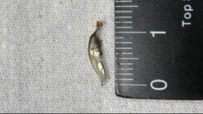 スープを口に含んだ児童が違和感 給食に長さ約1.2センチ、幅およそ2ミリの金属片 トマト缶のフタの一部が混入 山梨|TBS NEWS DIG
