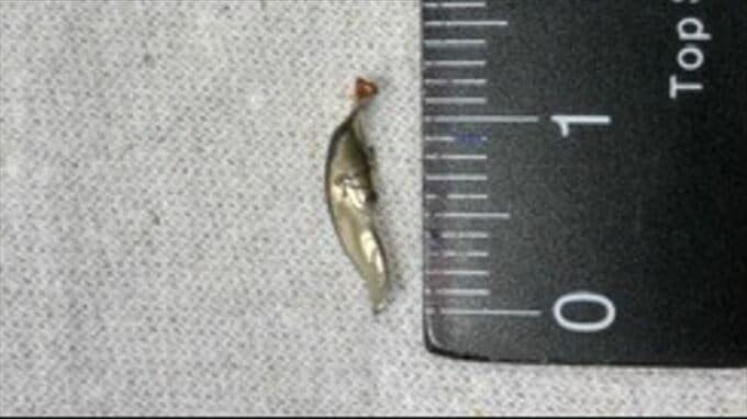 給食のラビオリスープに金属片　口に含んだ児童が気づく　食材の缶を開封した際に混入　甲府市・市立小学校　|　山梨のニュース | ＵＴＹテレビ山梨