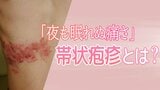20代~40代で「帯状疱疹」が“急増”の理由 顔面神経麻痺、視力障害のリスクも… 重要なのは「初期症状」|TBS NEWS DIG
