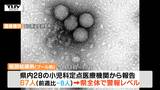 “手指の消毒、換気、マスクの適切な着用を”プール熱・溶連菌 警報レベル続く | 山形のニュース│TUYテレビユー山形