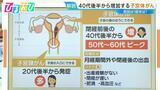 40代後半から増加「子宮体がん」初期症状は“不正出血” 検診の頻度やタイミングは【ひるおび】|TBS NEWS DIG