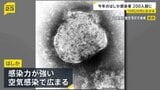 「はしか」感染広がる　10代…32%、20代…25%　今年の感染者236人（今月5日時点）|TBS NEWS DIG