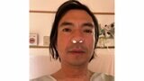 ふかわりょうさん　鼻の手術を報告　将来的に副鼻腔炎になる可能性があるため　「ご心配をおかけしました」|TBS NEWS DIG