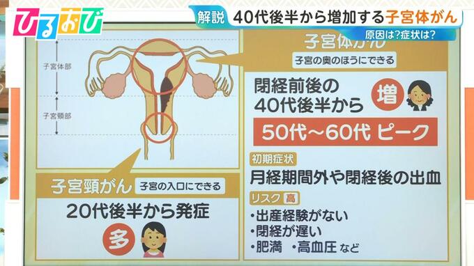 40代後半から増加「子宮体がん」初期症状は“不正出血”  検診の頻度やタイミングは【ひるおび】|TBS NEWS DIG