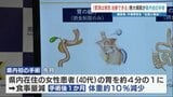 「胃を4分の1に切除」で体重10%減少 糖尿病・予備軍割合 “全国2番目”の熊本で初実施の肥満治療 手術の条件は|TBS NEWS DIG