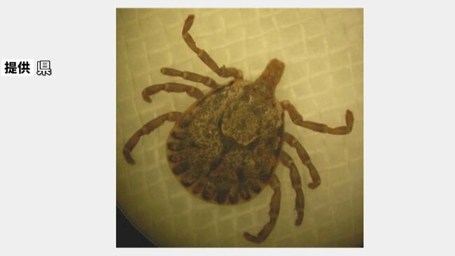 マダニ媒介感染症「SFTS」患者数が過去最多 全国で急増、大分県で13人|TBS NEWS DIG