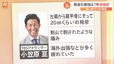 「二度とかかりたくない…」激痛で夜も眠れない“帯状疱疹” 50歳未満で発症率急増のワケとは？【Nスタ】|TBS NEWS DIG