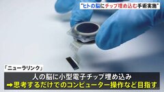 ヒト対象の脳インプラントを初実施…イーロン・マスク氏設立の「ニューラリンク」| TBS CROSS DIG with Bloomberg