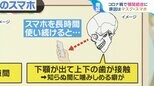 マスクやスマホが原因で“顎関節症”が増加 「日本人の2人に1人が経験」今すぐセルフチェックを!【ひるおび】|TBS NEWS DIG