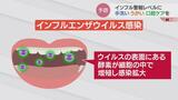 寝る前の歯みがきが効果的…インフルエンザ ウイルス酵素を活発にする “歯周病菌” 減らせ!インフル警報レベルで “手洗い うがい” に “口腔ケア” で徹底予防|TBS NEWS DIG