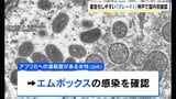 重症化しやすいエムポックスウイルス『クレード1』型への感染を国内で初確認 アフリカに渡航歴のある20代女性 神戸市|TBS NEWS DIG